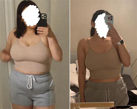 Transformation Stories: Ozempic Weight Loss Before And After