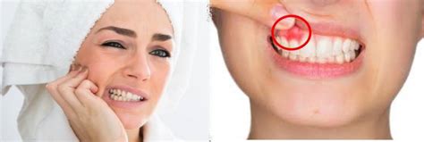 ampuh atasi sakit gigi gusi bengkak secara alami
