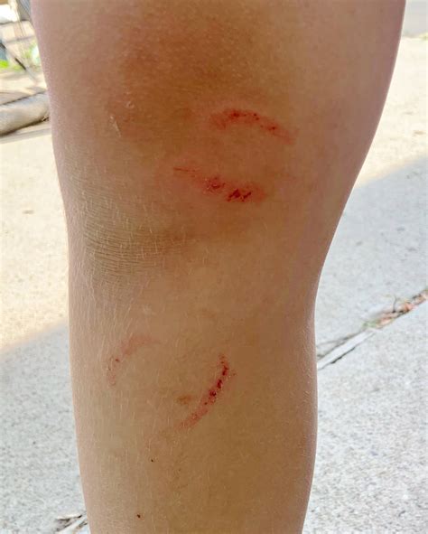 ways to fish biting naturally 7