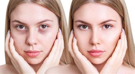 Free Face Yoga Exercises for Reducing Eye Bags [PDF]