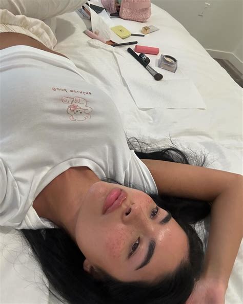 Clogged Pores 101 | Aisha, Couple picture poses, Clogged pores