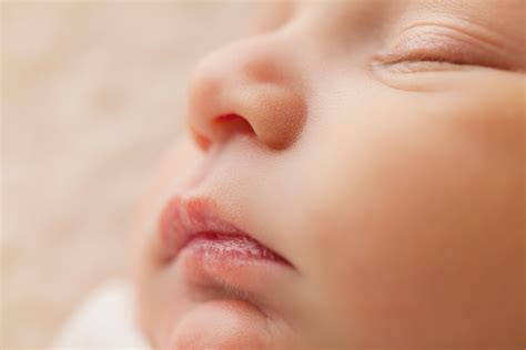 cara mengatasi gatal pada kulit bayi 7