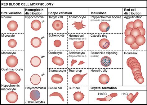 miscellaneous red cell abnormalities  hematologist understand