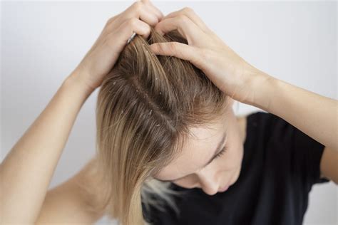Telogen Effluvium vs. Other Hair Loss Conditions: How to Tell the
