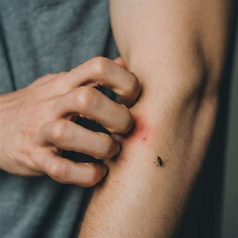 How Long Can Bed Bugs Survive Without Feeding? Let’s Find Out - ThermoPest