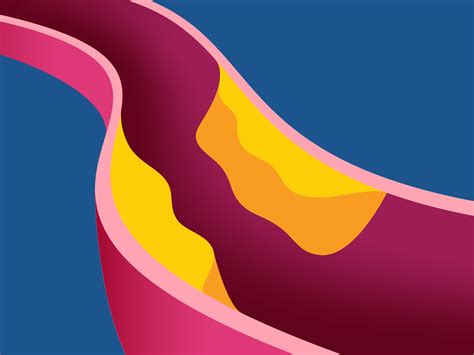 Vascular Health Clinics – Michigan’s #1 Vascular Program