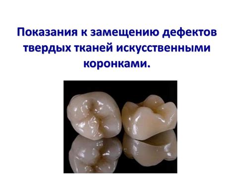Показания к замещению дефектов твердых тканей искусственными коронками ...