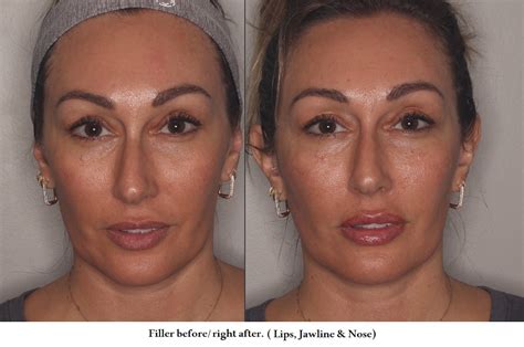 face    grossman dermatology