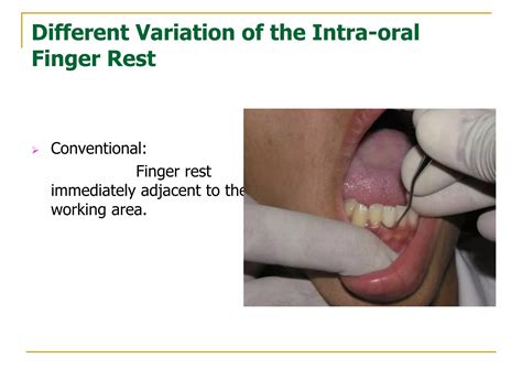 Principles of periodontal instrumentation | PPT
