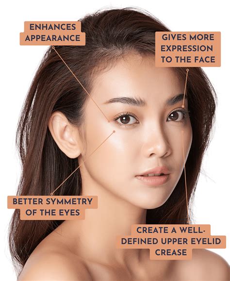 Double Eyelid Surgery/Epicanthoplasty Singapore - Allure Plastic Surgery