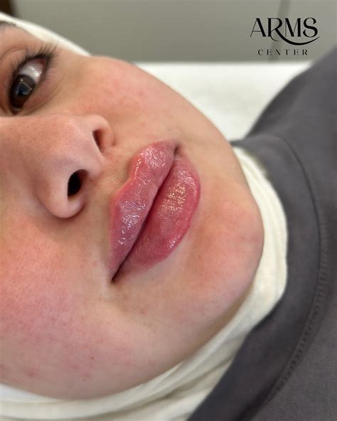 ‎مركز آرمز الطبي ARMS Medical Center‎ (@arms.center) • Instagram photos