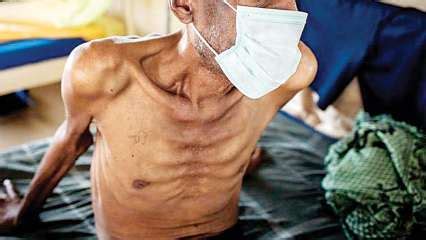 TB patients: Latest News, Videos and Photos on TB patients - DNA News