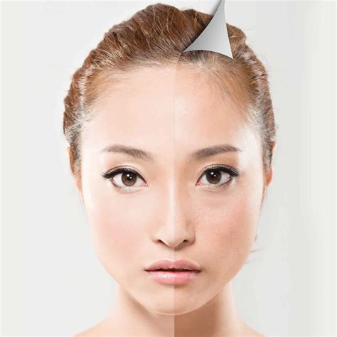 Medical Grade Facial - True Clinic