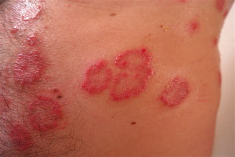 «rash» HD Wallpapers