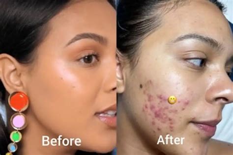 Shaving My Face Ruined My Life - The Unexpected Downfall