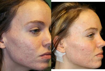 ematrix   pictures realself