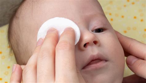 Exploring Eye Discharge in Newborns - World Eye Care Foundation