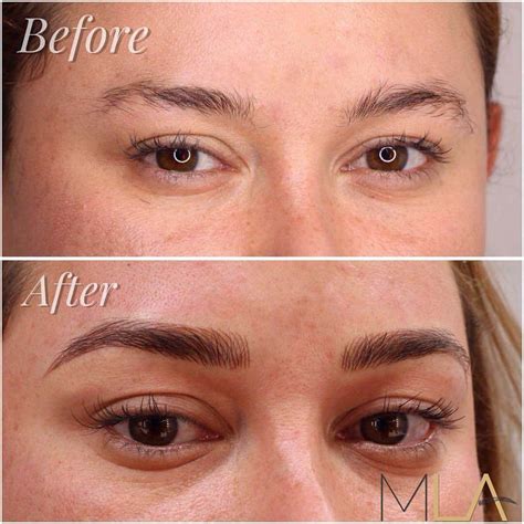 Permanent Makeup Eyebrows Before After Pictures