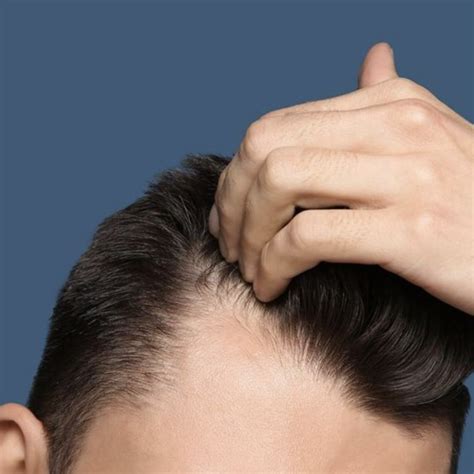 BIOLOGICS HAIR RESTORATION - BARE Skin and Laser