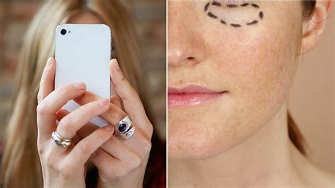 Plastic Surgery Trends for 2018 Shaped By Social Media | Allure