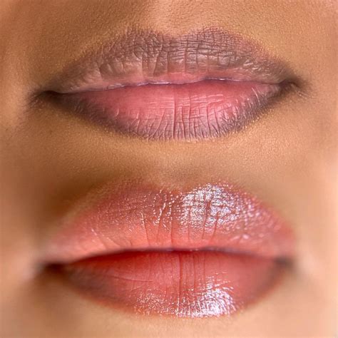 solution  dark lips lip neutralization
