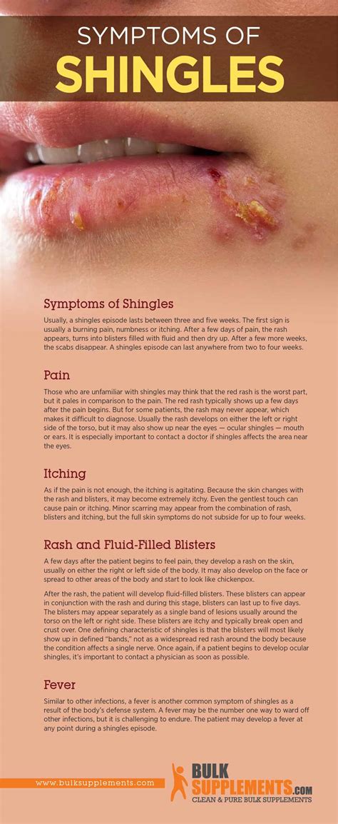 How Do Shingles Look When Healing at Eva Timmins blog