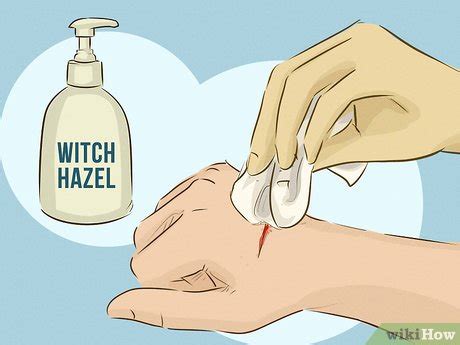 3 Ways to Stop Bleeding - wikiHow