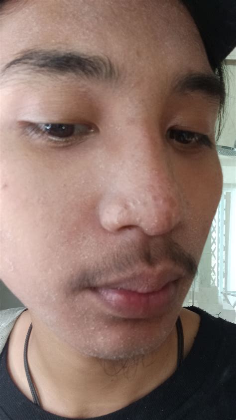 kulit muka hellosehat