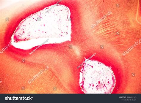teeth  microscope images stock  vectors shutterstock