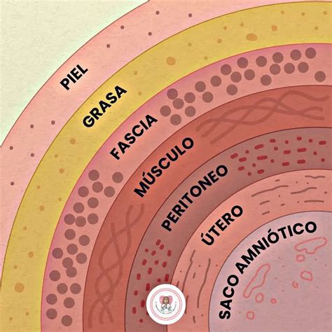 tu cuerpo es increible en una cesarea se atraviesan  capas