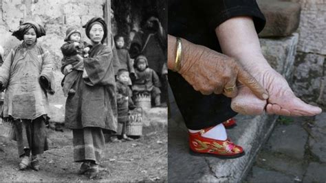 The Strange Practice of Chinese Foot Binding | The Internet Says it's True