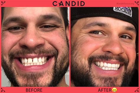 forum candid io: Before You Start, Read This - pjzquvc