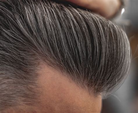 hair replacement new york 2