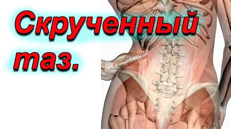 Скрученный таз.Анализ причин.Ошибки. - YouTube