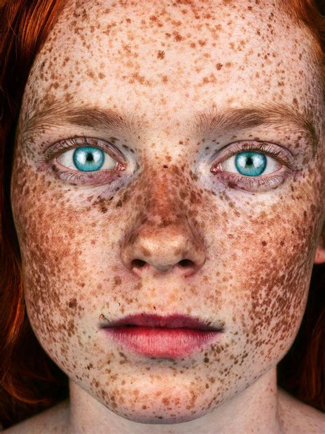 beauty  freckles  exploration   english charm justinboey