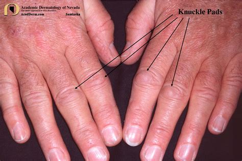 Knuckle Under Definition at Marjorie Dalton blog