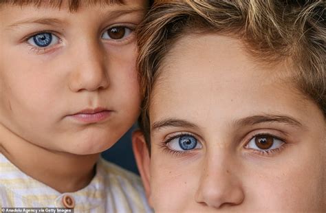 Brothers are born with stunning DIFFERENT-coloured eyes | Daily Mail Online