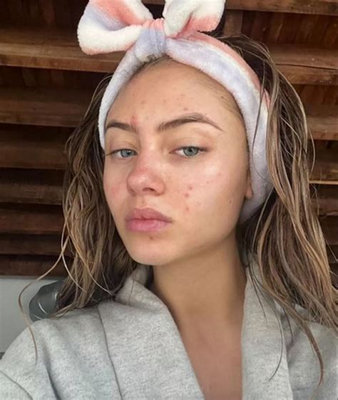 Celebrities No Makeup