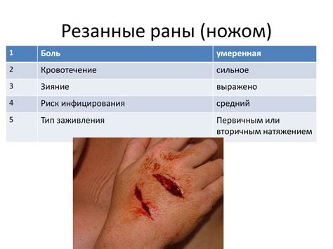 Открытые механические травмы. Уход за больными - презентация онлайн