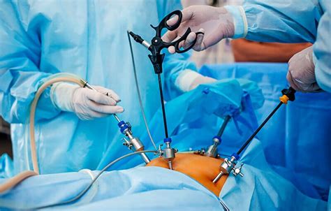 Лапароскопические операции — surgery-first.ru