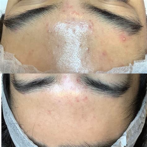 congested skin treatments wimbledon kensington london