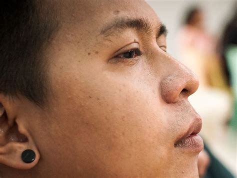 Eyebrow Piercing Scars: When They Happen and How to Heal Them