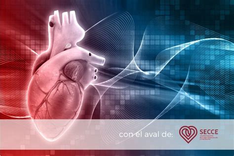 Cuánto sabes sobre cirugía cardiovascular – Sociedad Española de ...