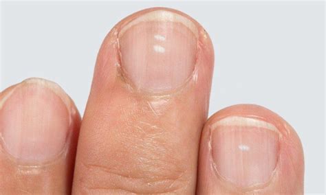 researchers explain   fingernails      health
