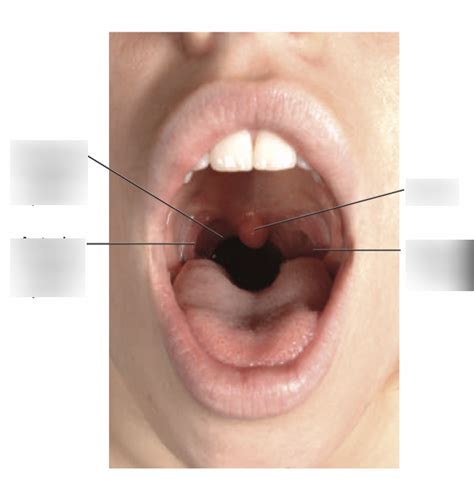 Anterior View of Faucial Pillars & Oral Cavity Landmarks Diagram | Quizlet
