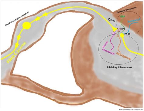 [Translated article] Pruritus in Dermatology: Part 1—General Concepts