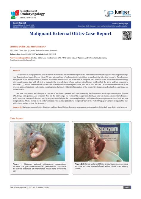 malignant external otitis case report