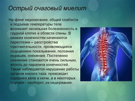 Острый миелит - презентация онлайн