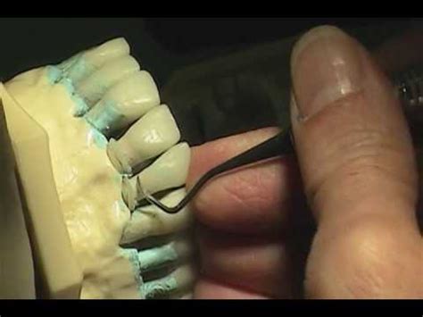Universal curet - YouTube