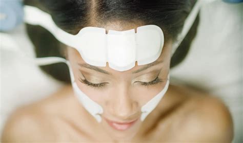em lift face  surgical face lift cosmedical skin solutions
